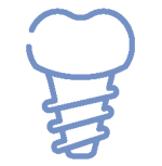 Niebieska linia przedstawiająca implant stomatologiczny, ukazująca podstawę w kształcie śruby i górną część w kształcie zęba. niebodent bemowo