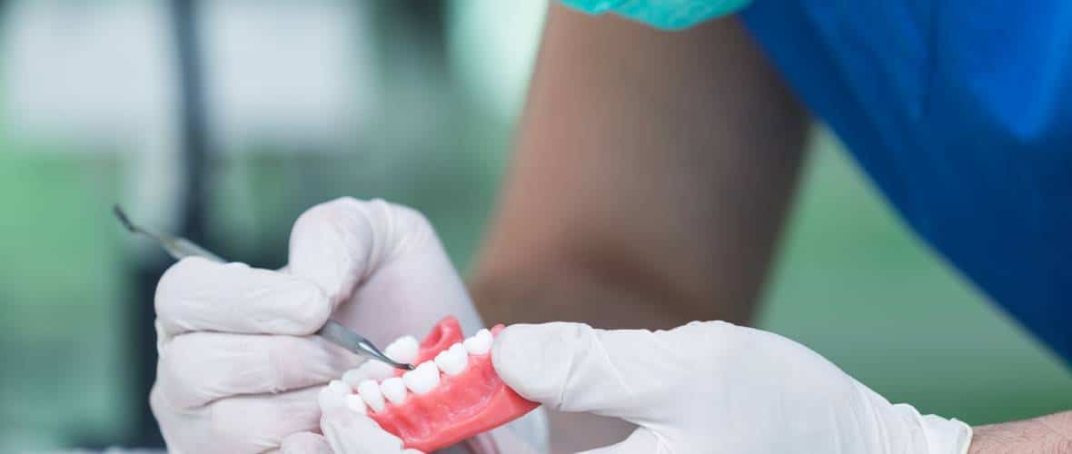 Protetyka stomatologiczna Bemowo - korony, mosty, implanty