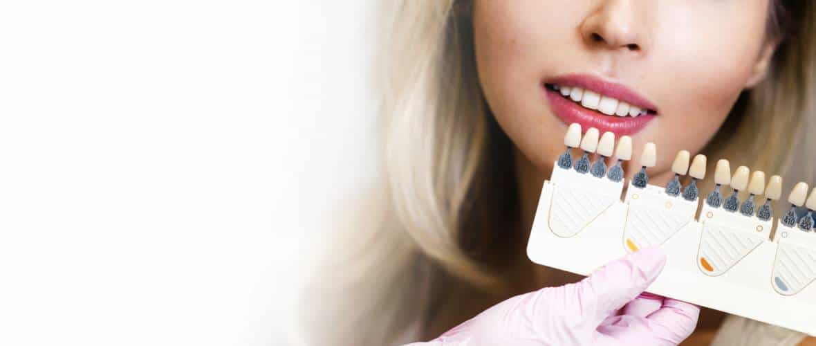 Stomatologia estetyczna