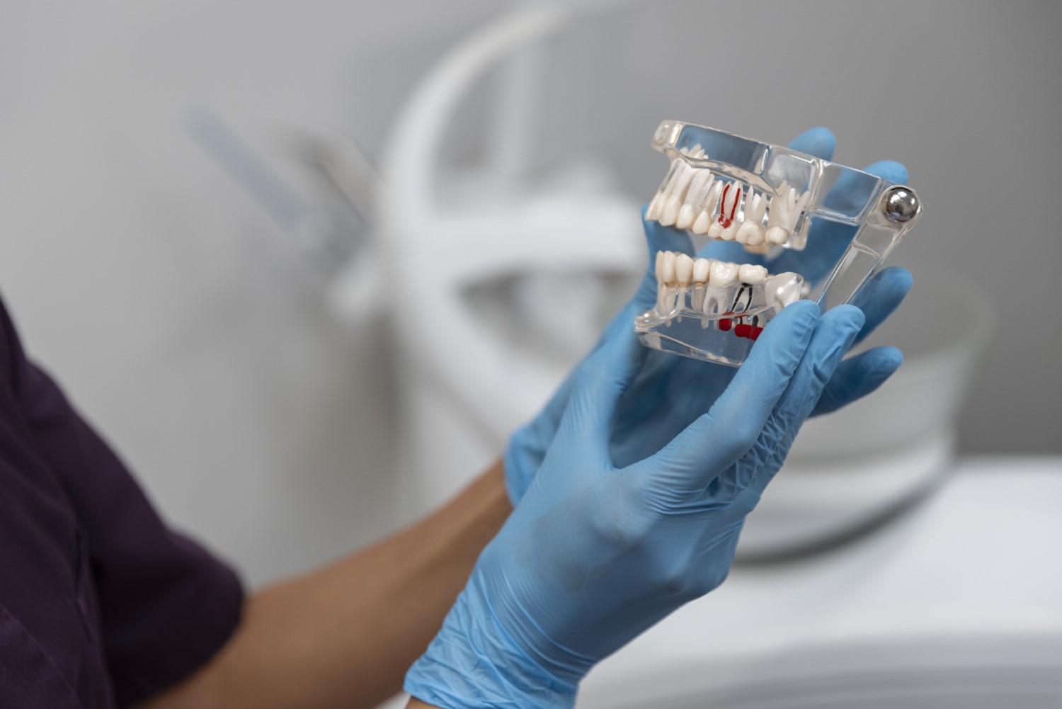 Implanty zębowe etapy leczenia